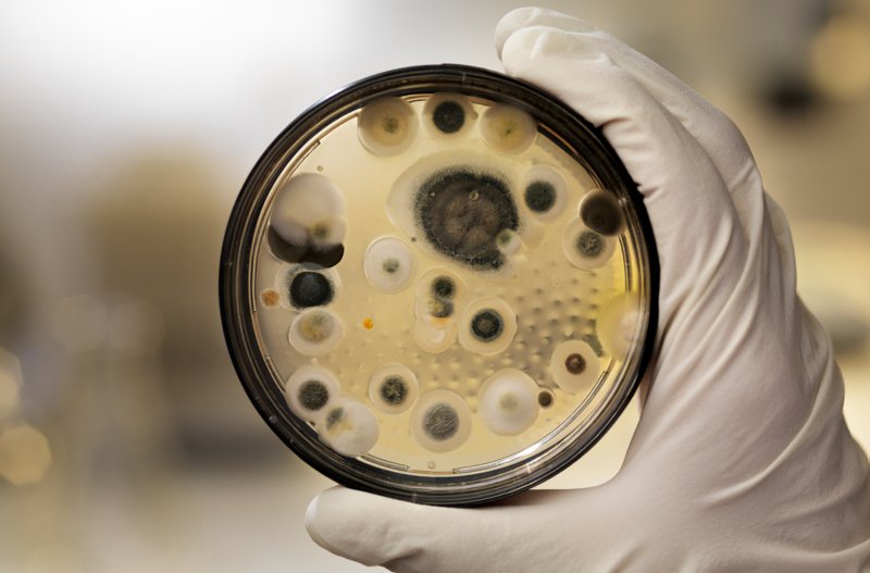 Plesne môžu mať mnoho podôb